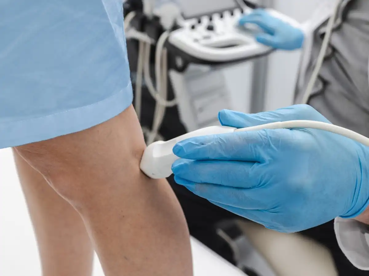 Ecografía Doppler realizada por la Dra. Soledad Gómez en Quito