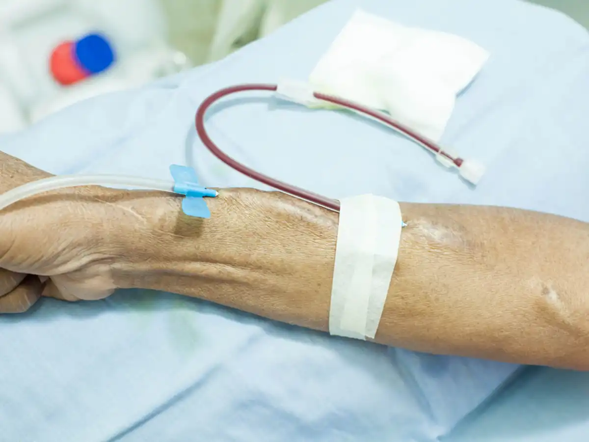 Evaluación con eco Doppler de un acceso vascular para hemodiálisis