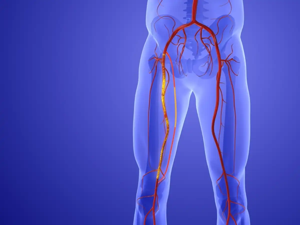 Evaluación de pulsos y circulación arterial de la pierna en consulta